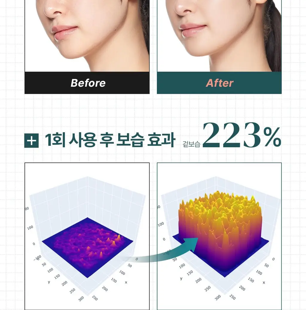 [최모나PICK][리쥬란 제약사_4배속 급속진정] 리쥬더마 EX 리페어링 크림 20g 상세페이지 16